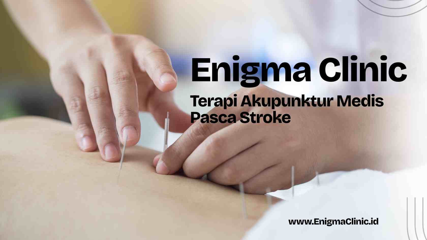 Enigma Clinic - Terapi Akupunktur Medis Pasca Stroke