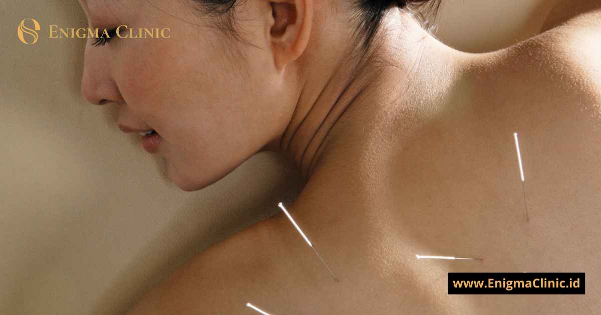Klinik Akupunktur Estetik untuk Perawatan Kulit di Pesanggrahan Jakarta